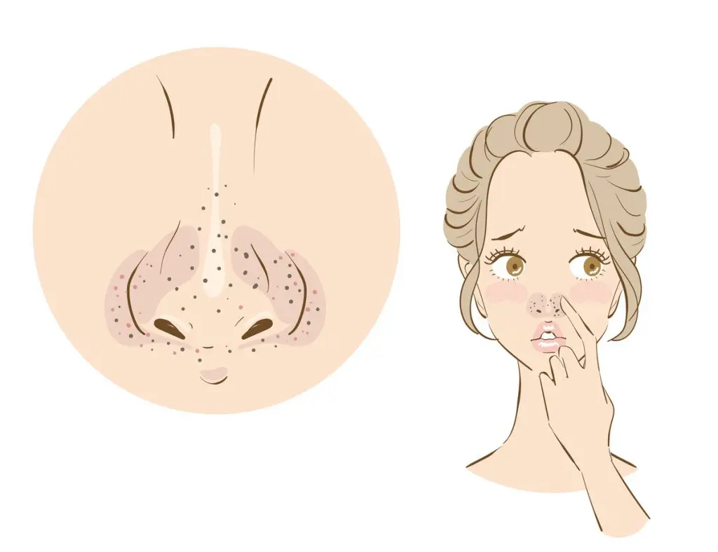 ヘルニア 107D36 | ヘルニア 国試 | テコプラ